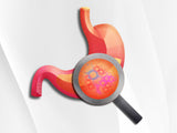 Gut Zoomer: Comprehensive Digestive Assessment