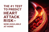 Heart Attack Risk Test + Practitioner Review - Home Urine Kit for Oxidative Stress