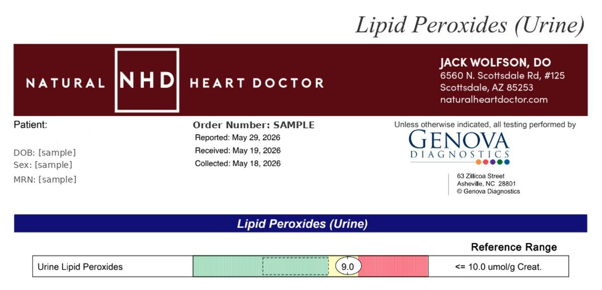 Sample Natural Heart Doctor lipid peroxides urine test report showing a result and its reference range